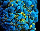 By National Institutes of Health (NIH) (National Institutes of Health (NIH)) [Public domain], via Wikimedia Commons