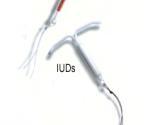 iud.jpg